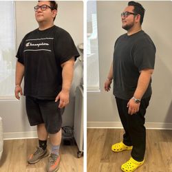 SoCal MedSpas - Down 50 pounds with semaglutide in 9 weeks