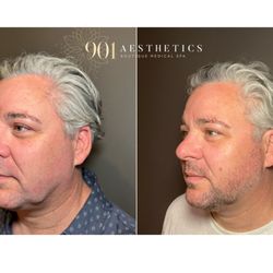 901 Aesthetics - Skin rejuvenation lifts, tightens, & brightens for a more youthful look.
