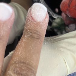 Nail World - Bloody middle finger after being file was told "relax"