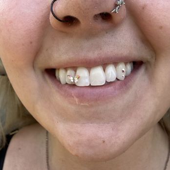 Million Dollar Smiles - Swarovski butterfly - Teeth Whitening Near Me - Kapolei, Hawaii Million Dollar Smiles - Swarovski butterfly - Teeth Whitening Near Me - Kapolei, Hawaii