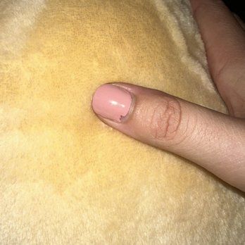 Wonderlust Nails Spa - Chipped nail near over flooded cuticles after a week of nail growth. - Nail Salons Near Me - Chandler, Arizona Wonderlust Nails Spa - Chipped nail near over flooded cuticles after a week of nail growth. - Nail Salons Near Me - Chandler, Arizona