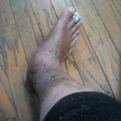 Anand Vora MD - Can't believe I paid to have this done.real lol nice !!
Thanks !!!