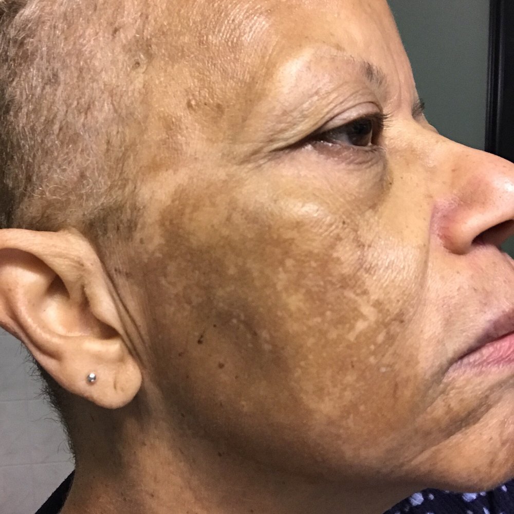 Daniel Zaghi, MD, MS - This is BEFORE any treatment from Dr Zaghi - Dermatologists Near Me - Los Angeles, California