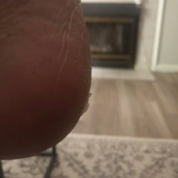 One hour after pedicure. Waste of money