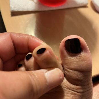 Pro Nail Spa - Injury from a horrible pedicure - Nail Salons Near Me - Chula Vista, California