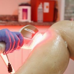 Avalon Medical Spa - Laser Hair Removal