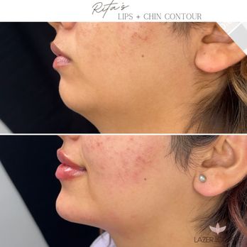 Lazer Lounge - Laser Hair Removal Near Me - Studio City, California Lazer Lounge - Laser Hair Removal Near Me - Studio City, California