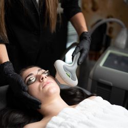Center for Aesthetic Medicine IPL treatment