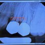 Soistman Family Dentistry & Associates