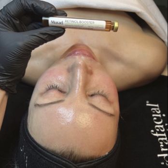 Skin At Invogue - Hydrafacial with Retinol Booster! - Skin Care Near Me - Montebello,, California Skin At Invogue - Hydrafacial with Retinol Booster! - Skin Care Near Me - Montebello,, California