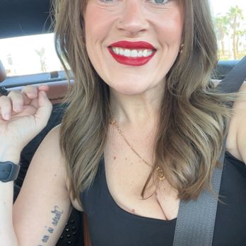 Revolution Wellness - After: Lip filler, Dysport, weight loss from Semaglutide - Nurse Practitioner Near Me - Las Vegas, Nevada Revolution Wellness - After: Lip filler, Dysport, weight loss from Semaglutide - Nurse Practitioner Near Me - Las Vegas, Nevada