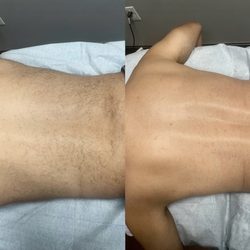 Rayo Esthetics