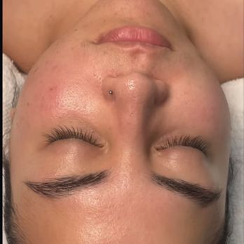 Diosa Glam Studio - Before facial - Waxing Near Me - Los Alamitos, California Diosa Glam Studio - Before facial - Waxing Near Me - Los Alamitos, California