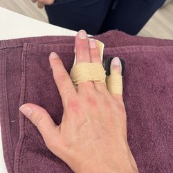 Lang Hand Therapy - Bind in Splint to allow for straightening of digits