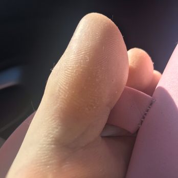 Lavish Nails & Spa - My foot after leaving a salon - Nail Salons Near Me - Chico, California Lavish Nails & Spa - My foot after leaving a salon - Nail Salons Near Me - Chico, California