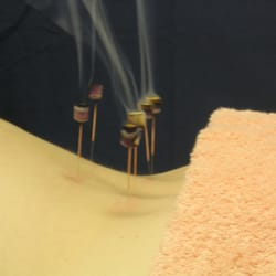 Acupuncture and moxibustion