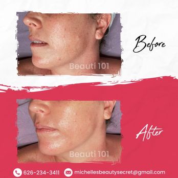 Beauti 101 - Skin Care Near Me - South Pasadena, California Beauti 101 - Skin Care Near Me - South Pasadena, California