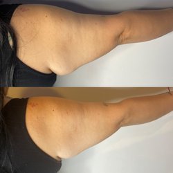 The Hourglass Method