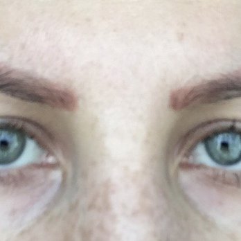 Electrolysis by Janet - Hair Removal Near Me - Glendale, California Electrolysis by Janet - Hair Removal Near Me - Glendale, California