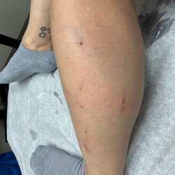 Innovative Vein