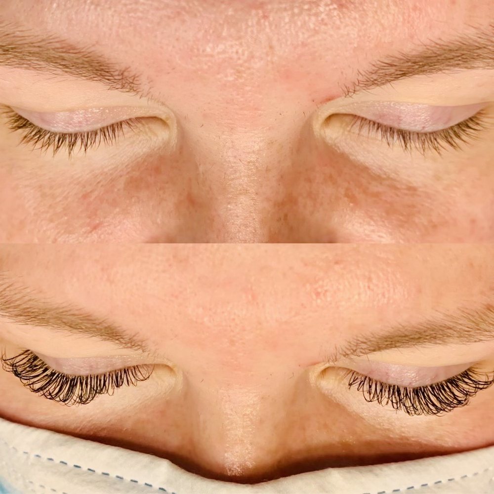 Facelogix Clinical Skincare & Makeover Center Logo