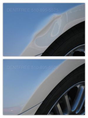 Photo of DentFree - San Leandro, CA, US.