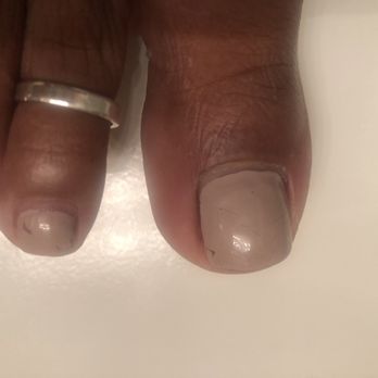 Phillip Nails - Chipped toes - Nail Salons Near Me - Antioch, California Phillip Nails - Chipped toes - Nail Salons Near Me - Antioch, California