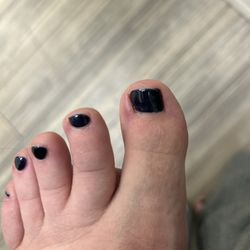 Ariel's Nails & Spa - Other swollen big toe from being dug at. This one is infected I believe and hurts very badly.
