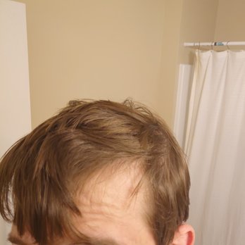 Mane Salon - Me looking like my hair is falling out, courtesy of Mane - Hair Salons Near Me - Raleigh, North Carolina