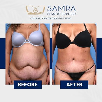 Said A Samra, MD, FACS