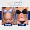 Asaad H. Samra, MD, FACS gift card