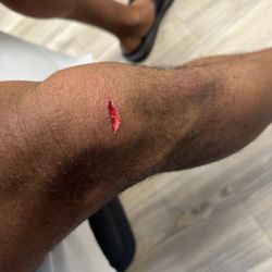 Peachtree Immediate Care - Midtown - Gash
