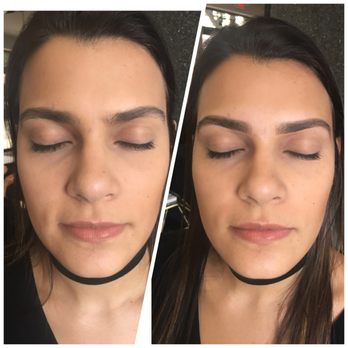 Atenea Beauty - Before and After by Atenea - Hair Removal Near Me - Miami, Florida Atenea Beauty - Before and After by Atenea - Hair Removal Near Me - Miami, Florida