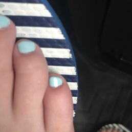 My toe nail that he made diagonal