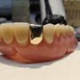 Photo of Powell'S High Tech Dental Studio