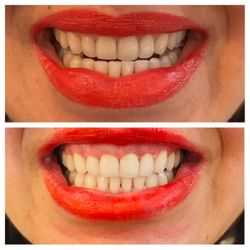 Serendipity Smiles - New year, new brighter smile!