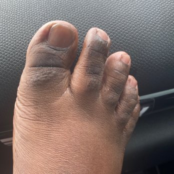 Diamond Nails and Spa - An uneven pedicure - Day Spas Near Me - Schererville, Indiana Diamond Nails and Spa - An uneven pedicure - Day Spas Near Me - Schererville, Indiana