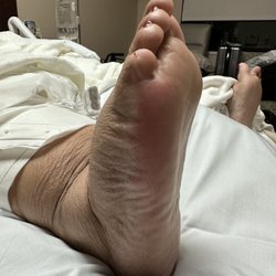 Texas Health Presbyterian Hospital - Caused pressure ulcer during my surgery.