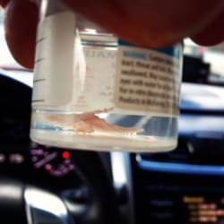 Jonathan Purisima DPM - Ingrown toenail removed
