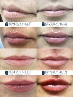 Beverly Hills Rejuvenation Center Westlake Village by null