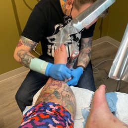 Tattooing