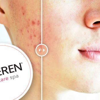 Oceren Skin Care - Skin Care Near Me - Tustin, California Oceren Skin Care - Skin Care Near Me - Tustin, California