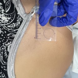 Australian Skin Cancer Clinics