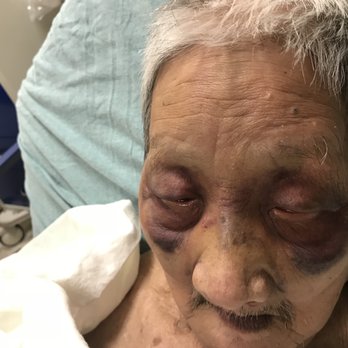 Rose Mountain Care Center - this is my father was struck by some other residence at Rose Mountain - Home Health Care Near Me - New Brunswick, New Jersey