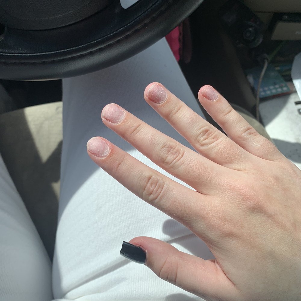 Tlc Nails & Spa - After her ripping them off - Nail Salons Near Me - Winter Garden, Florida