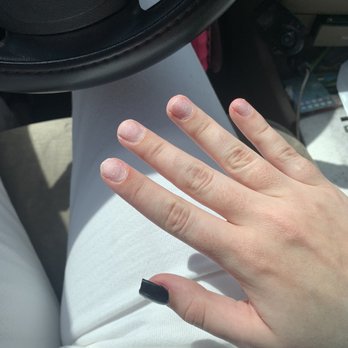 Tlc Nails & Spa - After her ripping them off - Nail Salons Near Me - Winter Garden, Florida Tlc Nails & Spa - After her ripping them off - Nail Salons Near Me - Winter Garden, Florida