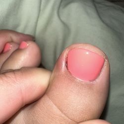 QT Nail Studio - Left toe was done first. It hurt but I was like you know what it happens. Move on.