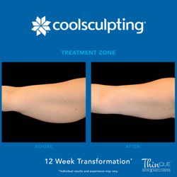 Thinique Skin & Wellness - Ask if CoolSculpting is right for you!!!
Buy 3 Treatments Get 1 FREE!!
