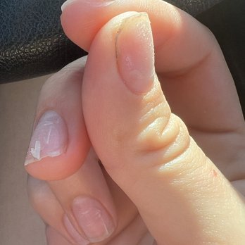 Holly Nails & Spa - the top layer of my nail coming off after completed acrylic removal - Nail Salons Near Me - Riverside, California Holly Nails & Spa - the top layer of my nail coming off after completed acrylic removal - Nail Salons Near Me - Riverside, California
