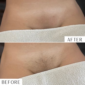 Melted Esthetic - Full Sugar Brazilian wax - Waxing Near Me - Downey , California Melted Esthetic - Full Sugar Brazilian wax - Waxing Near Me - Downey , California